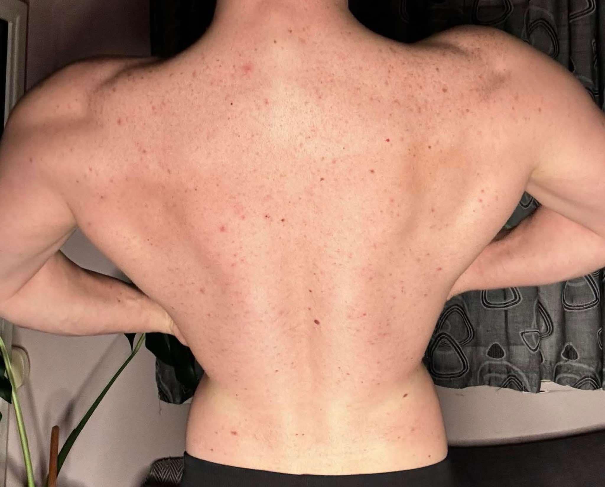 Themmiss Kullanıcısının Seksi ve Çıplak Fotoğrafları Gay Sex Cam