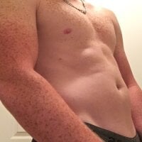 freckledginger369