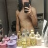 Vitiligo_Boy