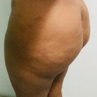 melaninchunk
