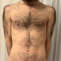hairybaldboy1