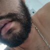 dickman10