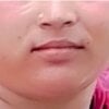 lipihotkapol