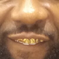 Goldmouf333333