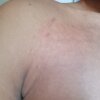 Supun_0322