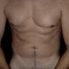 TheAddict-X