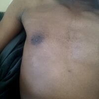 Bekisende webcam