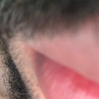 phellipestronda