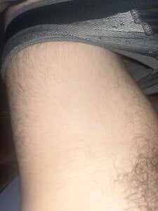 Goldendickinyou Bein Pic