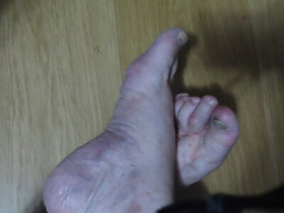 StiveMartin PÉS Pic