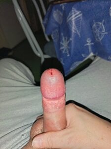 SugaryFinder1 Pero . fénykép