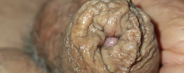 jhonschen's Tubo nell'uretra Sex Photo 8