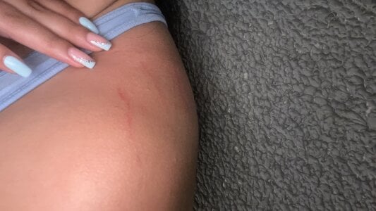 Annie9_ 🙂‍↔️  6. fénykép