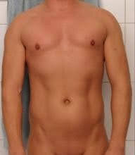 Goldmedall Man83 Pic