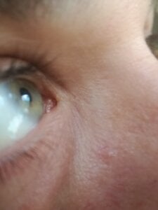 Ninfo920817 Public  5. fénykép