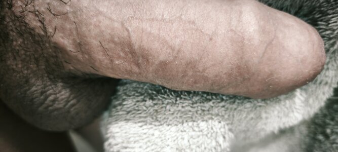 Yooop de Putobras99  2 fotos