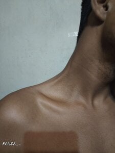 Long-termMarble56 P Pic 5