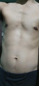 stripcut Nude Εικόνα