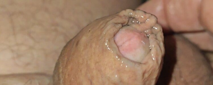 jhonschen's Tubo nell'uretra Sex Photo 2