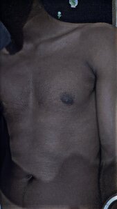 Long-termMarble56 P Pic 4