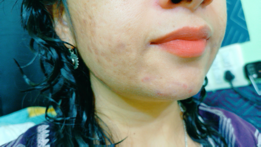 Public od Niha_kannada  3 snímek