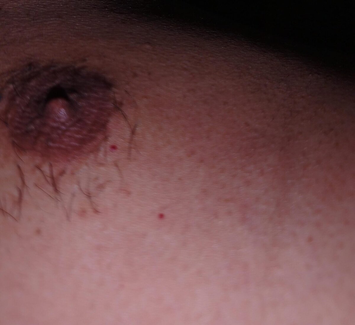 Foto  1709 de primaria123 – em alta