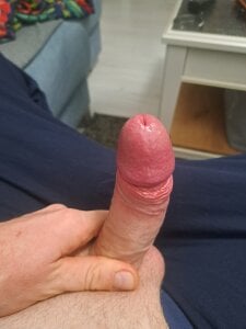 Vintermelon2 Public зображення