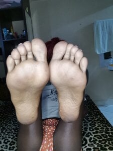 Skinoren kullanıcısının Public albümü -  fotoğraf