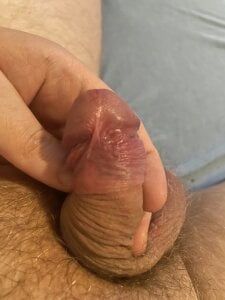 vorhauttree Mix Pic 2