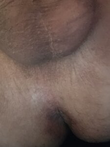 Public od HornieEMT  4 snímek