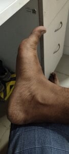 dr_hairy my feet Pic 2