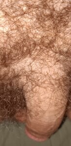 Aluntrus@xh Public Immagine  5