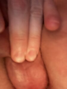 flaxlesh Test Εικόνα