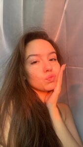 LisaSmiths I got fully Healed!!!!!!!!! Pic