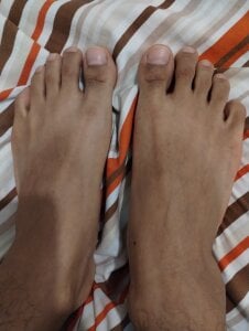 Engel420 FEET 👣❤️ Pic 4