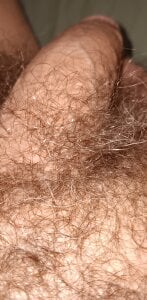 Aluntrus@xh Public Immagine  4