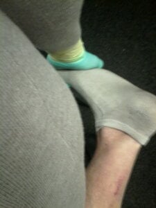 23FF_Toes Public Pic