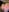 kInk_with_me Bruises ⛓️ Foto 5