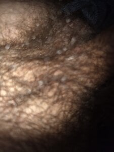 Nizza0104's XXX Nude Photo 1