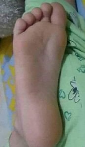 SUDOR20FEET Pies Pic 4