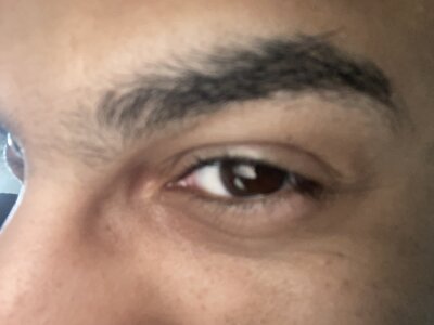 pauzudomoreno1 Eyes Pic 2