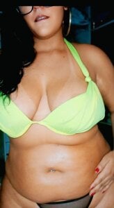 AuroraChest Public Pic 3