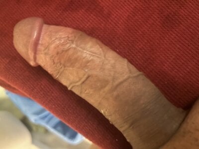 pegballdeep12345 Public slika 2