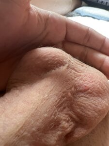 Nicfick Balls . fénykép