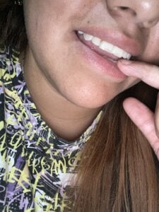 Babypalomi Up Εικόνα