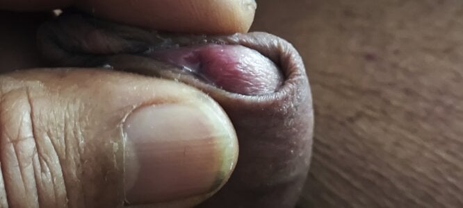 jhonschen's XXX Nude Photo 4