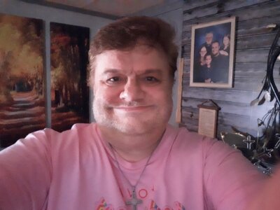 LooseSkin4U Weight Loss Journey  7. fénykép