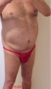 nudist_shmil nude wit friend Billede