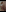 CandyShoopp: pussy close-up ( 8 фото)