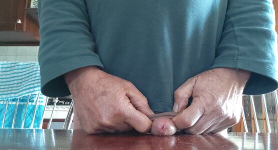 jhonschen's Allargamento del prepuzio Sex Photo 9